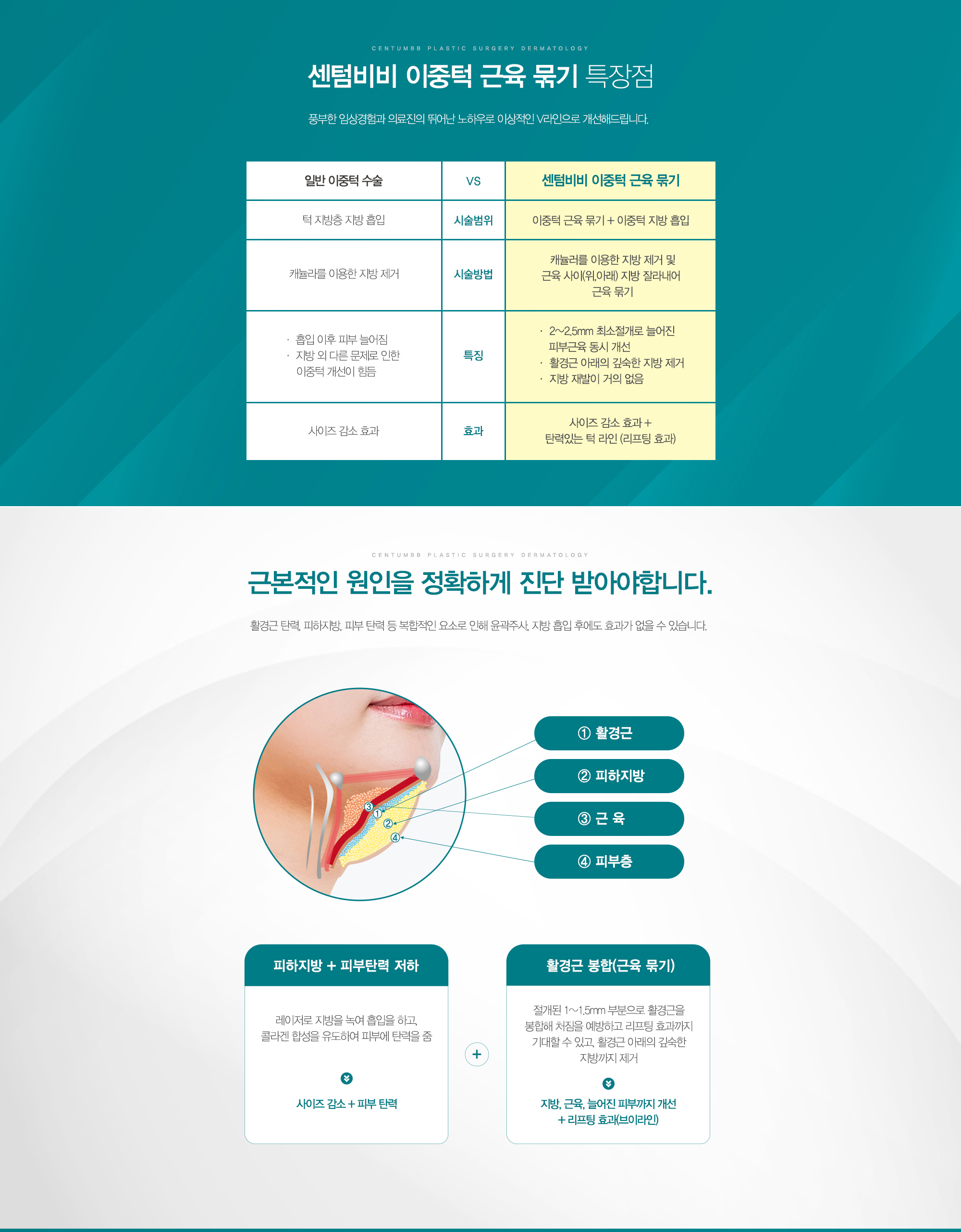 이중턱 근육 묶기